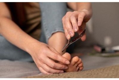 Ongle incarné : causes, traitements et prévention