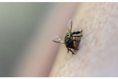 Piqûres d'abeille ou de guêpe : comment réagir ?